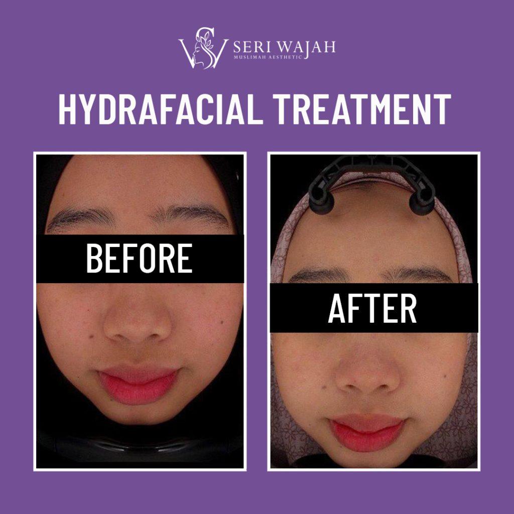 TESTIMONI BEFORE AFTER 2