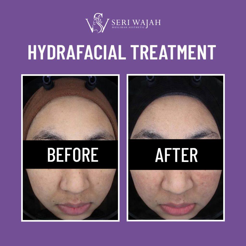 TESTIMONI BEFORE AFTER 3